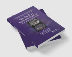 Handbook of Radioembolization