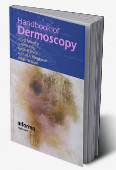 Handbook of Dermoscopy