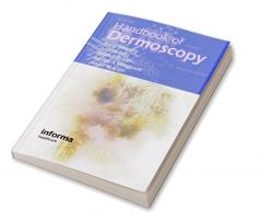 Handbook of Dermoscopy