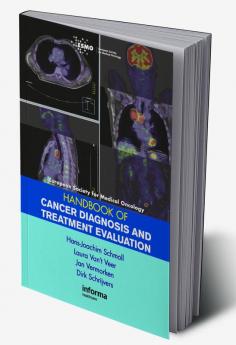 ESMO Handbook of Cancer Diagnosis and Treatment Evaluation