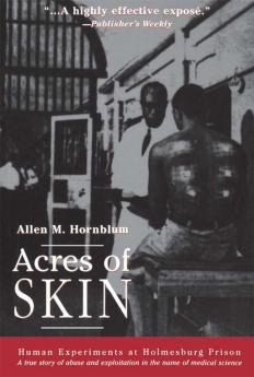 Acres of Skin