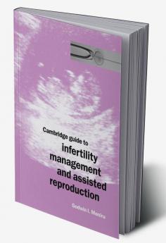 Cambridge Guide to Infertility Management and Assisted Reproduction