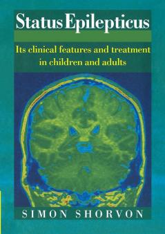 Status Epilepticus
