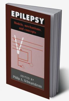 Epilepsy
