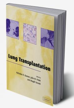 Lung Transplantation