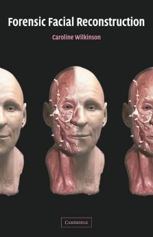 Forensic Facial Reconstruction