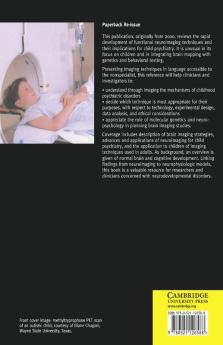 Functional Neuroimaging in Child Psychiatry