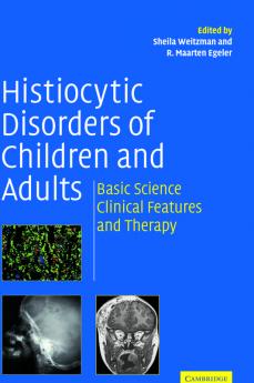 Histiocytic Disorders of Children and Adults