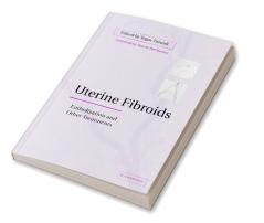 Uterine Fibroids