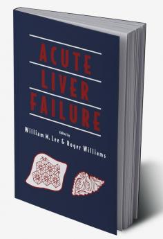 Acute Liver Failure