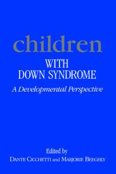 Children with Down's Syndrome