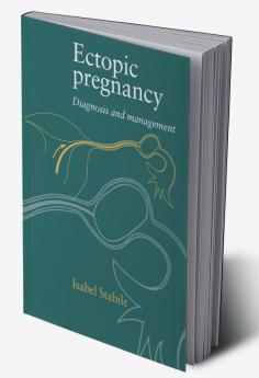 Ectopic Pregnancy