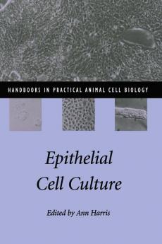 Epithelial Cell Culture