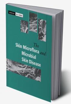 The Skin Microflora and Microbial Skin Disease