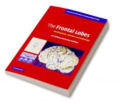 The Frontal Lobes