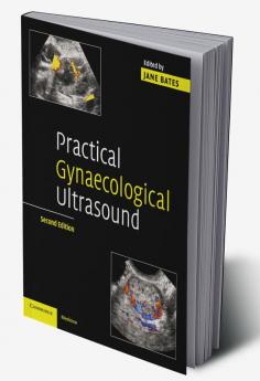 Practical Gynaecological Ultrasound