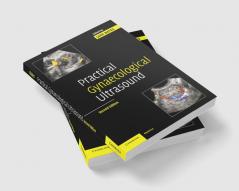 Practical Gynaecological Ultrasound