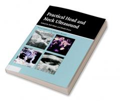 Practical Head & Neck Ultrasound