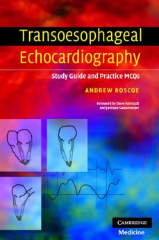 Transoesophageal Echocardiography