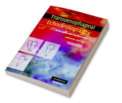 Transoesophageal Echocardiography