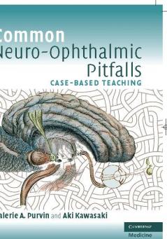 Common Neuro-Ophthalmic Pitfalls