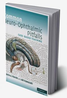 Common Neuro-Ophthalmic Pitfalls