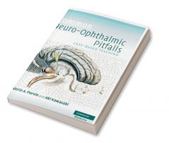 Common Neuro-Ophthalmic Pitfalls