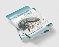 Common Neuro-Ophthalmic Pitfalls