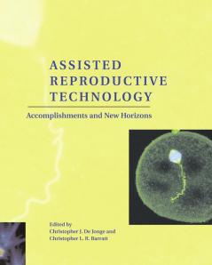 Assisted Reproductive Technology