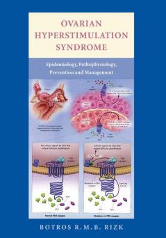Ovarian Hyperstimulation Syndrome