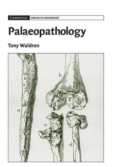 Palaeopathology
