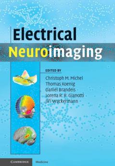 Electrical Neuroimaging
