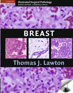 Illustrated Surgical Pathology of the Breast