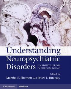 Understanding Neuropsychiatric Disorders