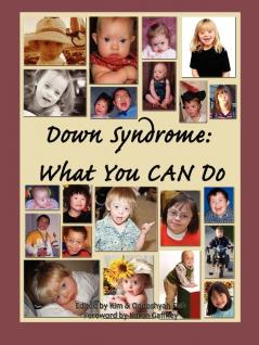 Down Syndrome