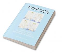 Torticollis