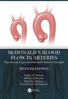 McDonald’s Blood Flow in Arteries