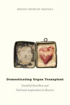 Domesticating Organ Transplant