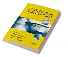 Fractures of the Shoulder Girdle