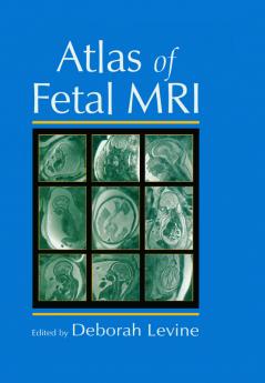 Atlas of Fetal MRI