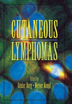 Cutaneous Lymphomas