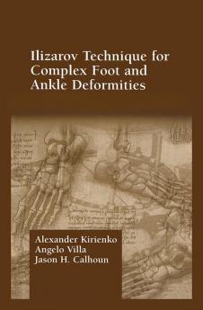 Ilizarov Technique for Complex Foot and Ankle Deformities