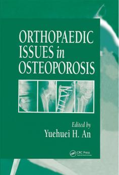 Orthopaedic Issues in Osteoporosis