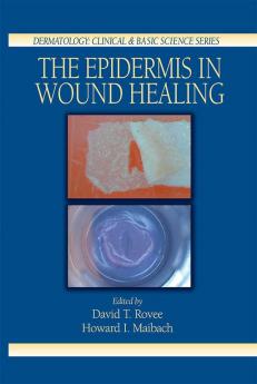 Epidermis in Wound Healing