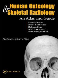 Human Osteology and Skeletal Radiology