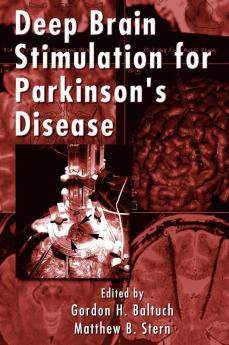 Deep Brain Stimulation for Parkinson's Disease
