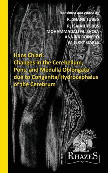 Changes in the Cerebellum Pons and Medulla Oblongata due to Congenital Hydrocephalus of the Cerebrum