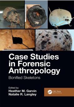 Case Studies in Forensic Anthropology