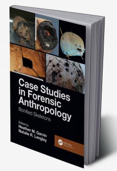 Case Studies in Forensic Anthropology