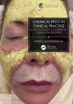 Chemical Peels in Clinical Practice